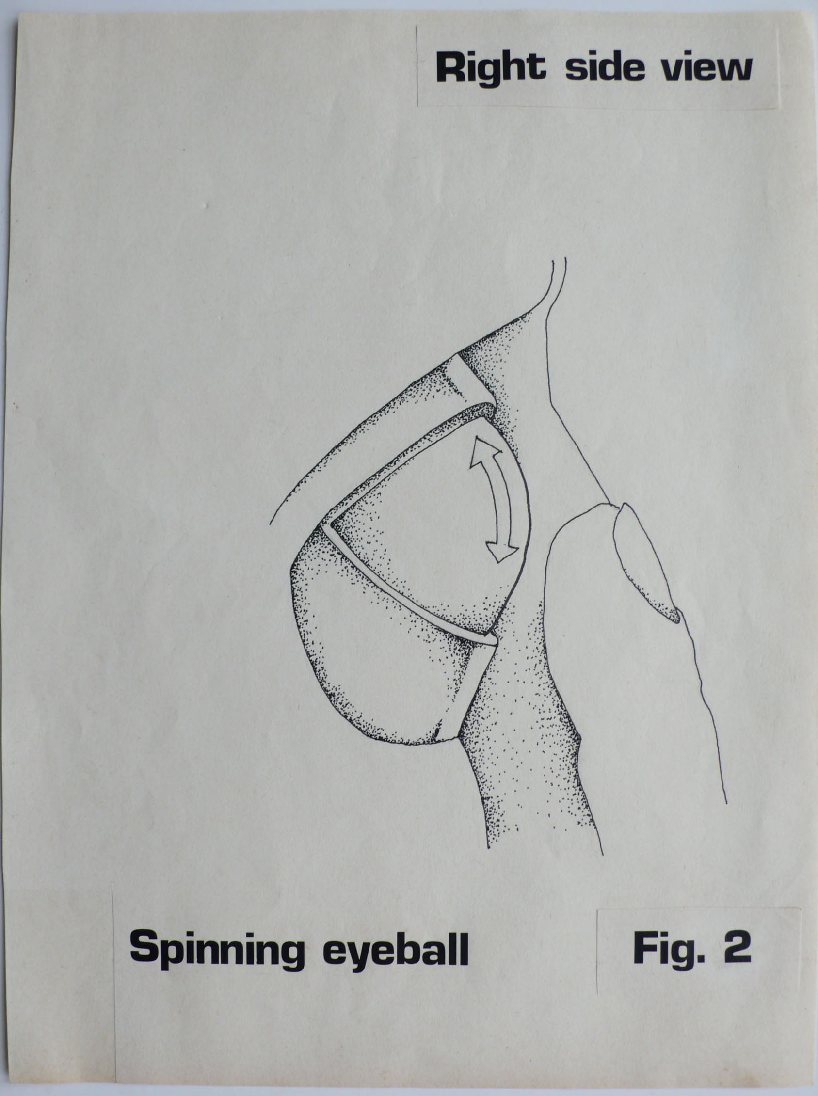 M 1978 00 00 lomholt spinning eyeballs 002